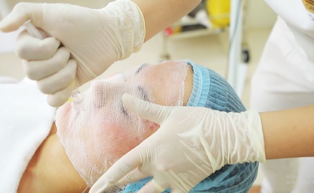 PRF Treatment