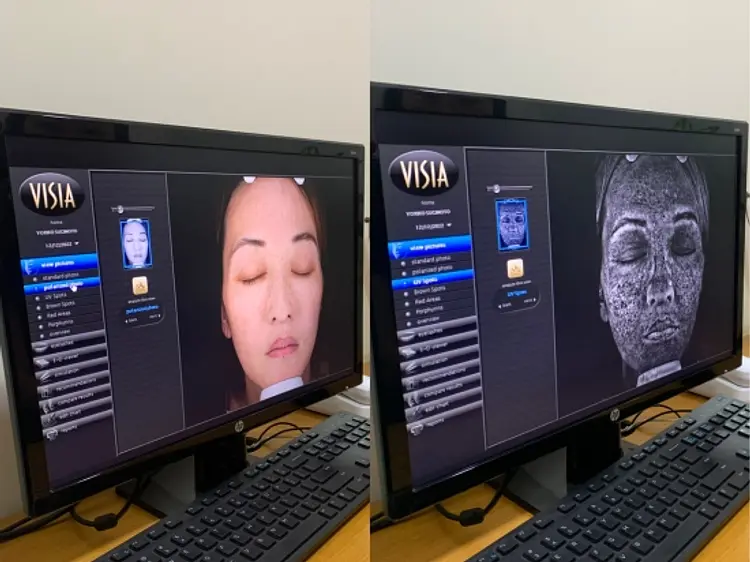 ロートアオハルクリニック ベトナム