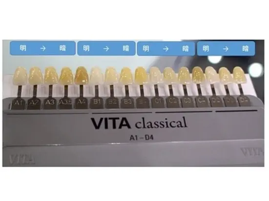 美しい歯を取り戻してみませんか？