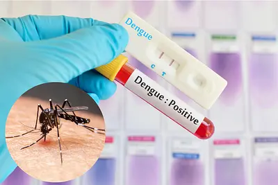 デング熱にご注意を！旅行者・在住者必見の予防と最新ワクチン情報