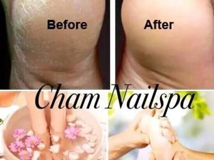 チャム・ネイル・スパ