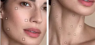 プロファイロ× BAP法による総合的な肌再