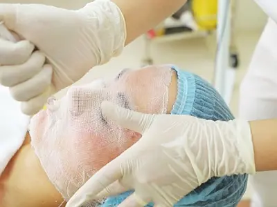 PRF Treatment