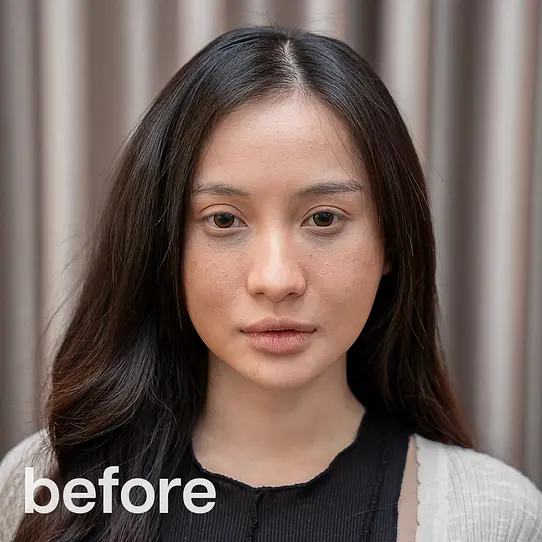 ROHTO AOHAL CLINICの「パーソナライズされた治療計画」。最短ルートで美肌へ導く