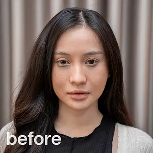 ROHTO AOHAL CLINICの「パーソナライズされた治療計画」。最短ルートで美肌へ導く