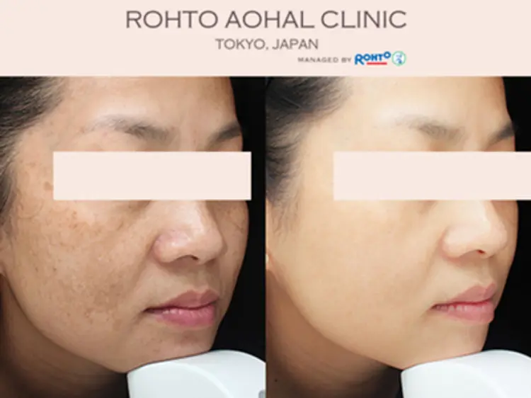 ロートアオハルクリニック ベトナム