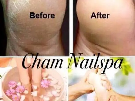 チャム・ネイル・スパ