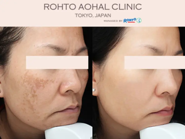 ロートアオハルクリニック ベトナム